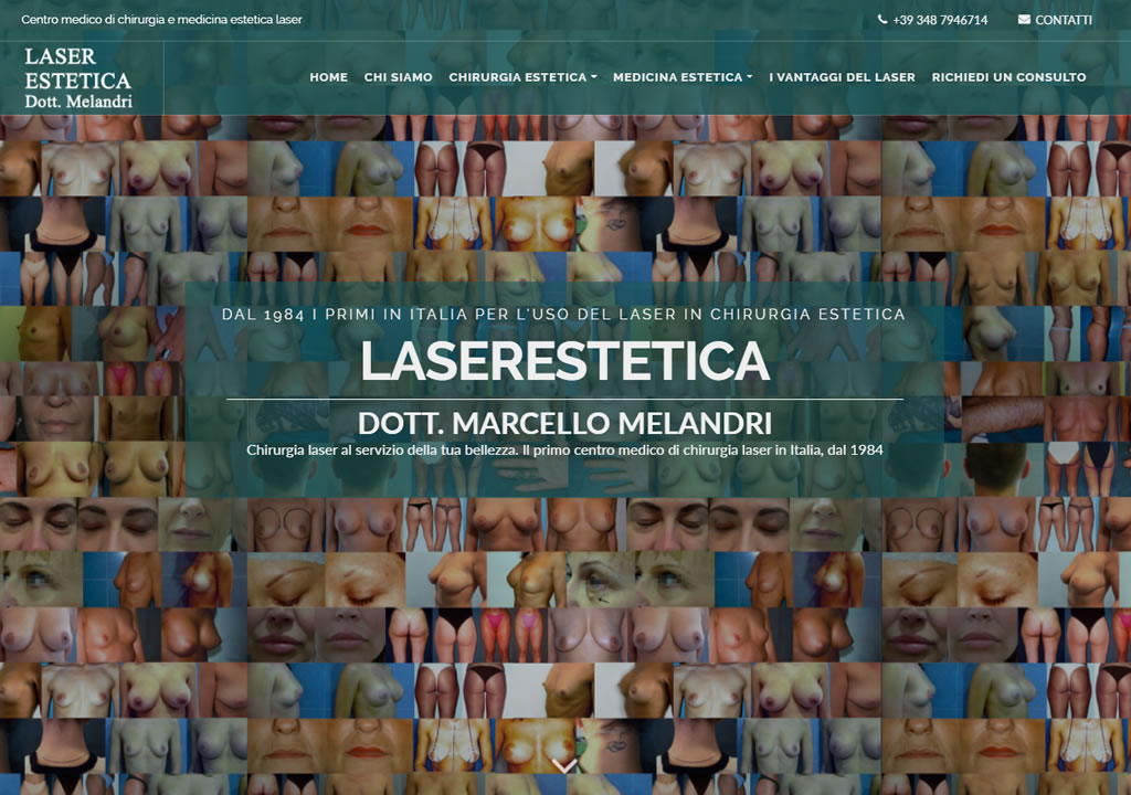 Laserestetica